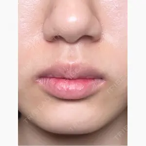 R Beauty CLINIC 銀座院口コミ