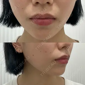 TCB東京中央美容外科 渋谷西口院口コミ
