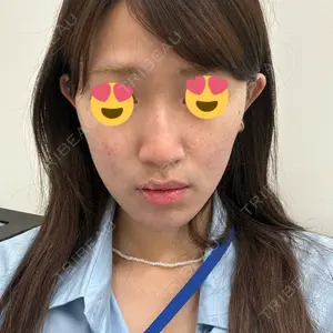 TCB東京中央美容外科 横浜駅前院口コミ