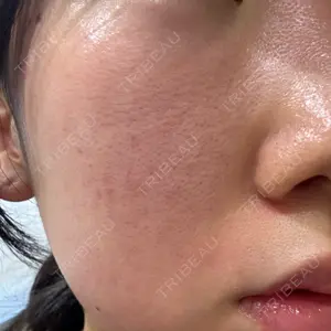 名駅なぎクリニック口コミ
