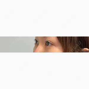 プラザ美容外科口コミ