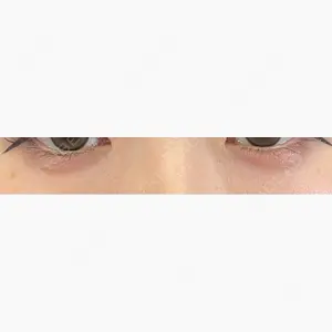 Leap beauty clinic口コミ