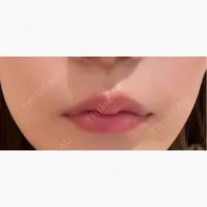 KAUNIS CLINIC（カウニスクリニック）口コミ