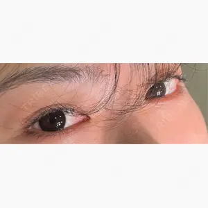HAAB×DREAM BEAUTY CLINIC 大阪梅田院口コミ