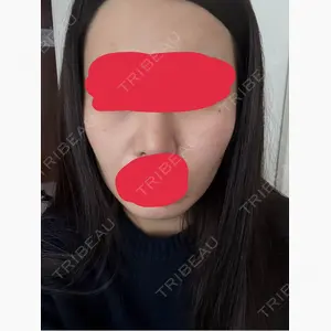 セギム美容整形外科口コミ