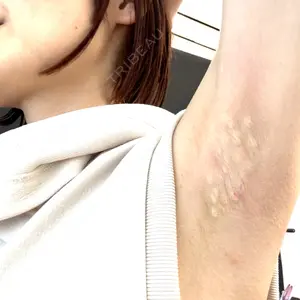 ルラ美容クリニック 渋谷本院口コミ