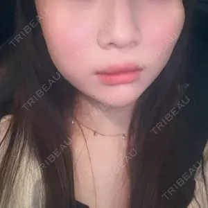 Nクリニック伏見口コミ