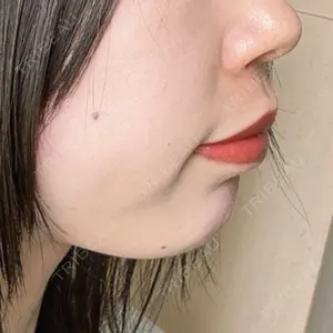 ルラ美容クリニック 岡山院口コミ