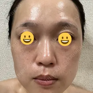 ゆきスキンクリニック 東池袋口コミ