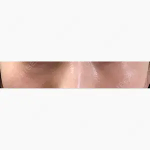 マルーンビューティースキンクリニック口コミ