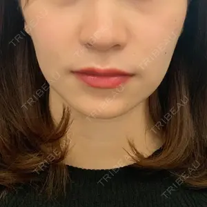 リエンジャン整形外科 弘大店口コミ