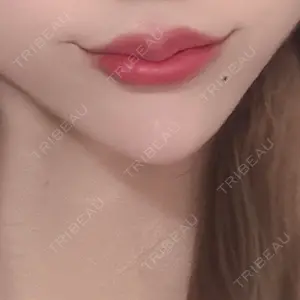 NARU Beauty Clinic 【ナルクリ】 水戸院口コミ