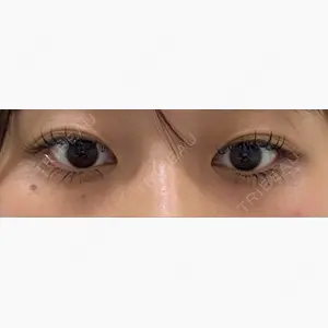 Brandnew Beauty Clinic口コミ