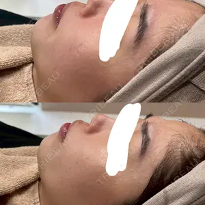 Re:anne clinic 銀座 【リアンクリニック銀座】口コミ