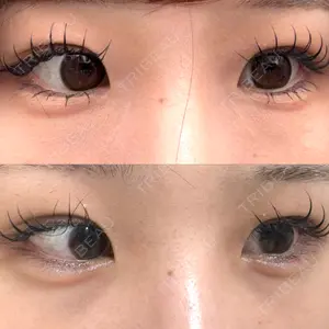 ルラ美容クリニック 渋谷本院口コミ