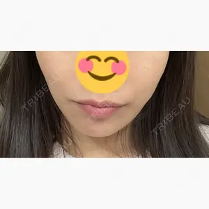 ルラ美容クリニック 岐阜院口コミ