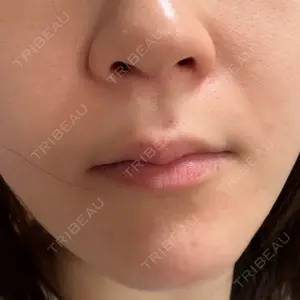 おおたかの森ビューティークリニック口コミ