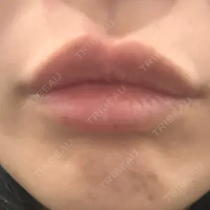新宿Ladies&Gentlemen美容クリニック口コミ