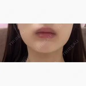 フィラークリニック 大阪梅田院口コミ