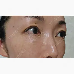 TCB東京中央美容外科 青森院口コミ