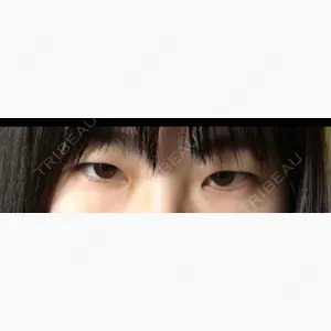 ジュエリー美容外科口コミ