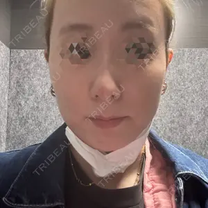 TCB東京中央美容外科 北千住院口コミ