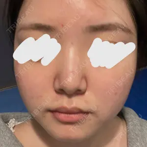 PureMe Skin Clinic（ピュアミースキンクリニック麻布）口コミ