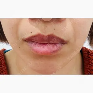 TCB東京中央美容外科 静岡院口コミ