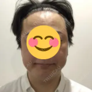 HAAB×DREAM BEAUTY CLINIC 東京本院口コミ