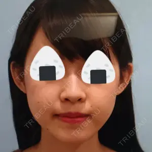 ビクアスクリニック口コミ