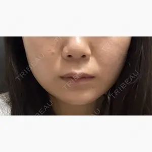 Wi Clinic （ウィ クリニック）心斎橋院口コミ