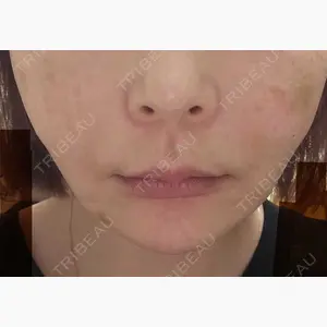 PRO CLINIC プロクリニック 銀座院口コミ