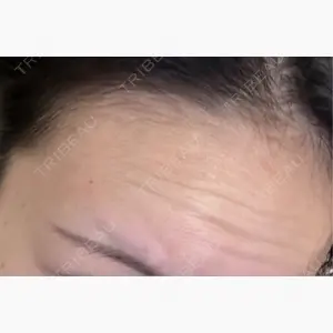 ルラ美容クリニック 新宿院口コミ