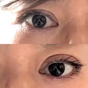 スマートスキンクリニック 神保町院口コミ