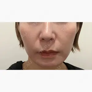 ルラ美容クリニック 渋谷本院口コミ