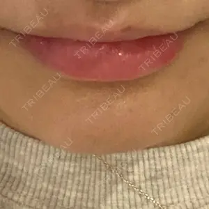ルラ美容クリニック 岐阜院口コミ
