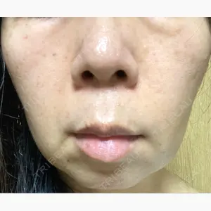 ルラ美容クリニック 渋谷本院口コミ