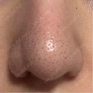 美容皮膚科エルムクリニック 福岡院口コミ