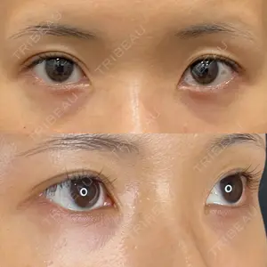 藤・ナチュレ美容クリニック 銀座院口コミ