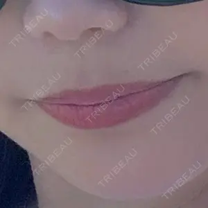 ルラ美容クリニック 千葉院 / ルラスキンクリニック 千葉院口コミ