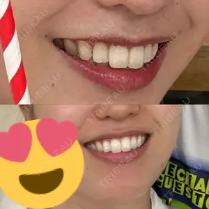 目黒まついデンタルクリニック口コミ