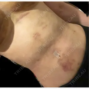 WOM SALON【術後ケア取扱いサロン】口コミ