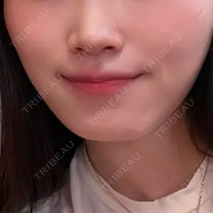 ルラ美容クリニック 大阪本院口コミ