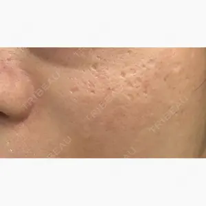 Re:anne clinic 銀座 【リアンクリニック銀座】口コミ