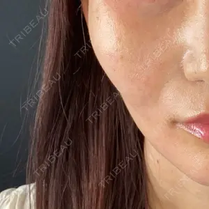 Brandnew Beauty Clinic口コミ