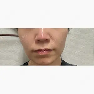 CZEN CLINIC 銀座院口コミ