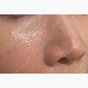 SUNMELIA SKIN CLINIC口コミ