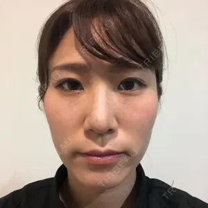ソウルクイーン整形外科（旧コエンミ整形外科）口コミ