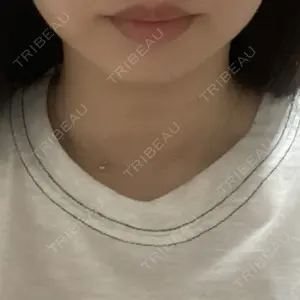 フォンタナクリニック天神口コミ