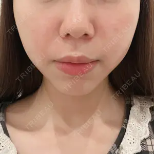 共立美容外科 渋谷院口コミ